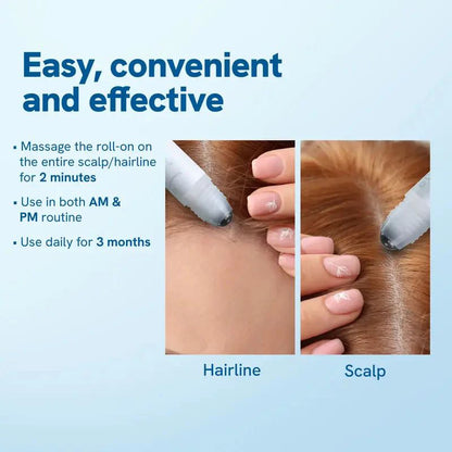Last 3 hours 60% off⏰Hair Growth Roll-On Serum – See hair growth in 4 weeks